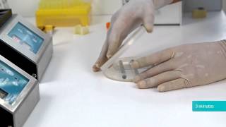 Antisperm Antibody Iga Direct