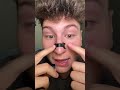 This is Incredible #nosestrips #breathing #snoring #sale