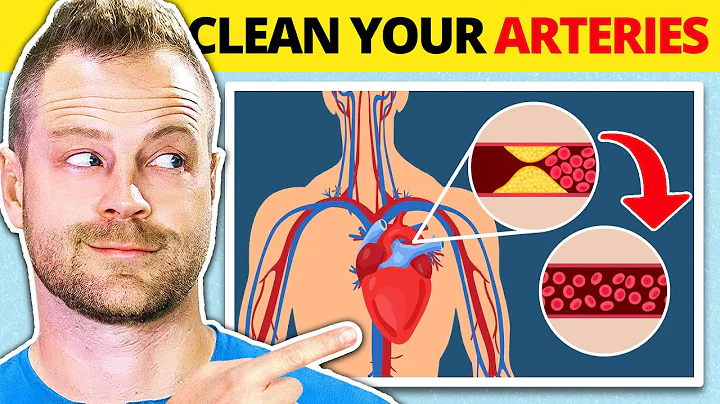 Prevent Heart Attacks and More with the 15 BEST He...