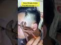shocking view pimple under microscope 🤯🔬 #shortvideo #shockingfacts #microscope #expriment #pimple