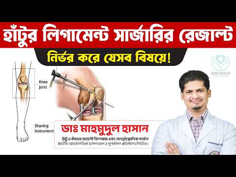 হাঁটুর লিগামেন্ট সার্জারির রেজাল্ট নির্ভর করে যেসব বিষয়ে | পুরোপুরি সুস্থ হওয়া সম্ভব?