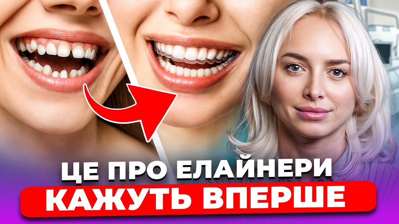 ВІД ЕЛАЙНЕРІВ БОЛЯТЬ ЗУБИ?! Як насправді працюють КАПИ? ЩО краще: БРЕКЕТИ чи ЕЛАЙНЕРИ?