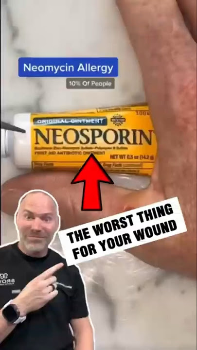 Use This Instead of Neosporin!
