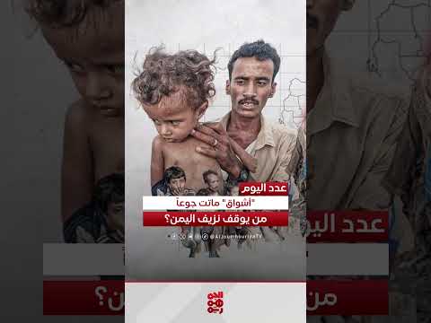 وفاة طفلة يمنية جوعاً في مخيم للنازحين بحجة