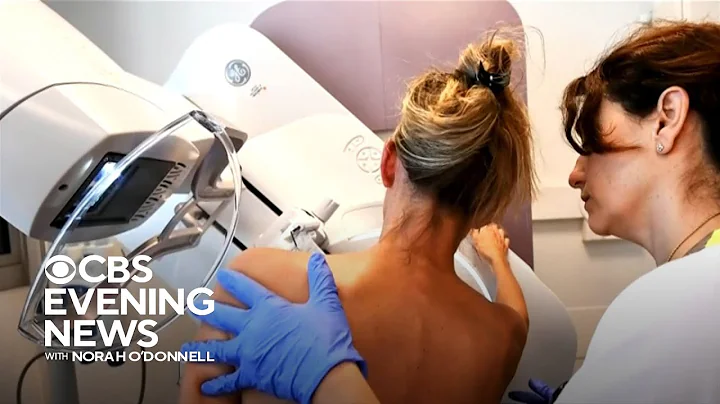 Study says AI better at predicting cancer risk