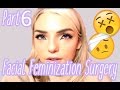 Facial Feminization Surgery - Week 3! |  | Stef Sanjati