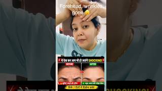 👉 Sirf 2 Minute Daily Aur Dekhiye Farq! ##ForeheadWrinkles #foreheadlines