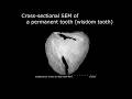 [Life] Cross-sectional SEM of a permanent tooth (wisdom tooth)