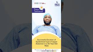 Sudan Patient Review - Successful Epidermoid Cyst Removal from Upper Abdomen