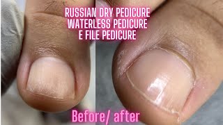 Dry waterless pedicure| russian pedicure, E-FILE PEDICURE | FULL PROCESS