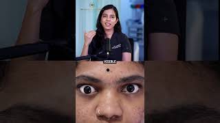 Does artificial eye look fake after eye surgery hindi | Dr Anamika Joshi| #artificialeye #eyesurgery