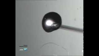 Embryo Biopsy technique video Part2