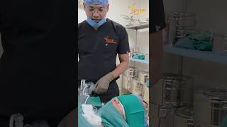 Keloid Removed in Real Time!  #keloidtreatment #skinhealing #ytshorts #shorts