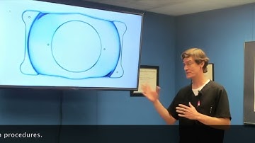 ICL (Implantable Contact Lens)