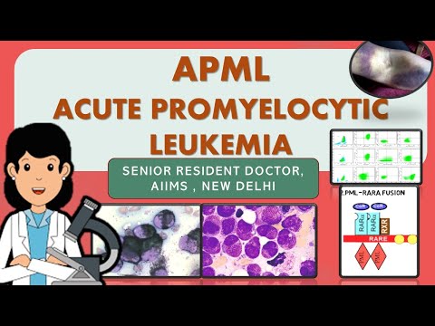 APML | PML RARA fusion  Acute Promyelocytic Leukemia ( Rapid review!!!)