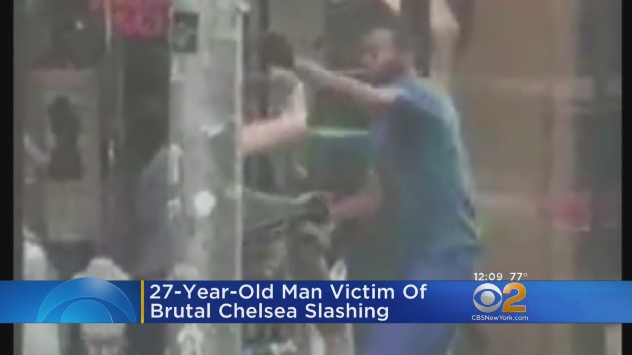 Man's Face Slashed Multiple Times In Chelsea