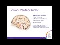 Locating Brain Tumors with Brain Mapping & Surgical Planning