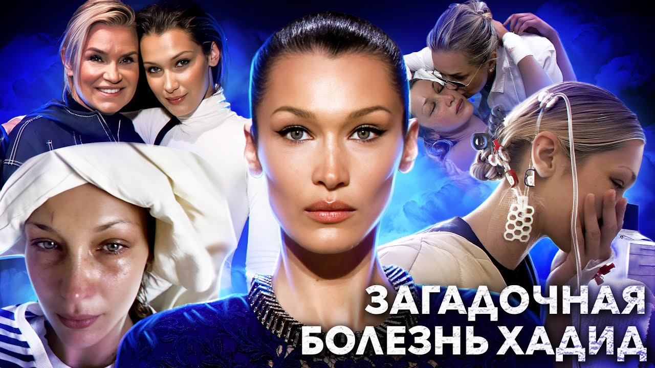ТАЙНА БЕЛЛЫ ХАДИД: так ли реальна болезнь Лайма семейства Хадид? поклонники бьют тревогу...