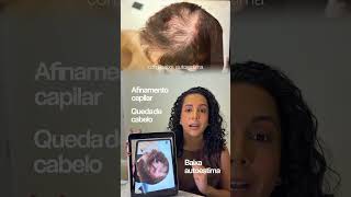 Queda, afinamento e recuperação capilar: veja esse resultado