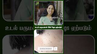 உடல் பருமனால் Skin Problem வரும் - Dr Sowmya Dermatologist obesity overweight skincare doctor