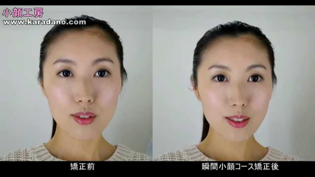 小顔矯正の前後動画ver２ 小顔工房 瞬間小顔コース Youtube