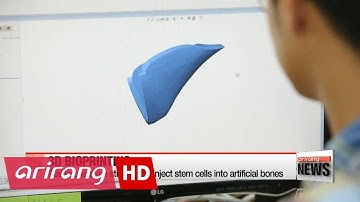 3D bioprinter prints artificial bones for medical purposes