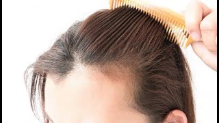 علاج مفصل و شامل لجميع اسباب تساقط الشعر