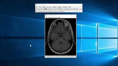 ImageJ/Fiji Tutorial : Creating Montage from Stack Tiff