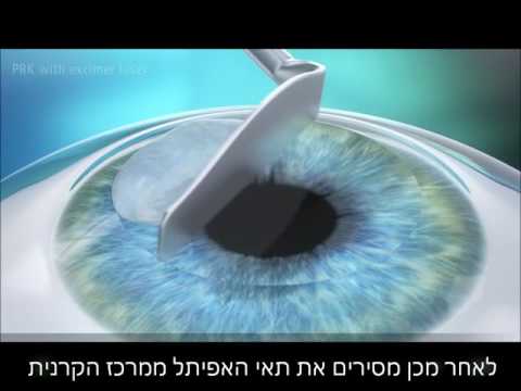 וִידֵאוֹ: איך מייצרים לייזרים?