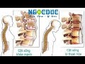 Thoái hóa cột sống: triệu chứng, biến chứng, nguyên nhân và cách điều trị