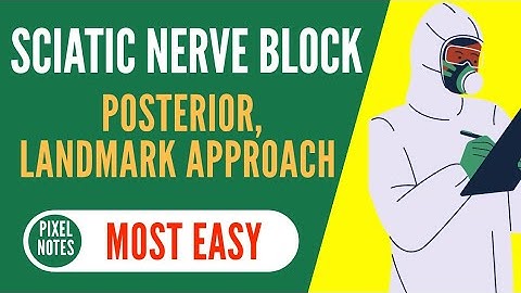 Sciatic Nerve Block | Posterior Approach | Classical Sciatic Nerve Block | Landmark Technique