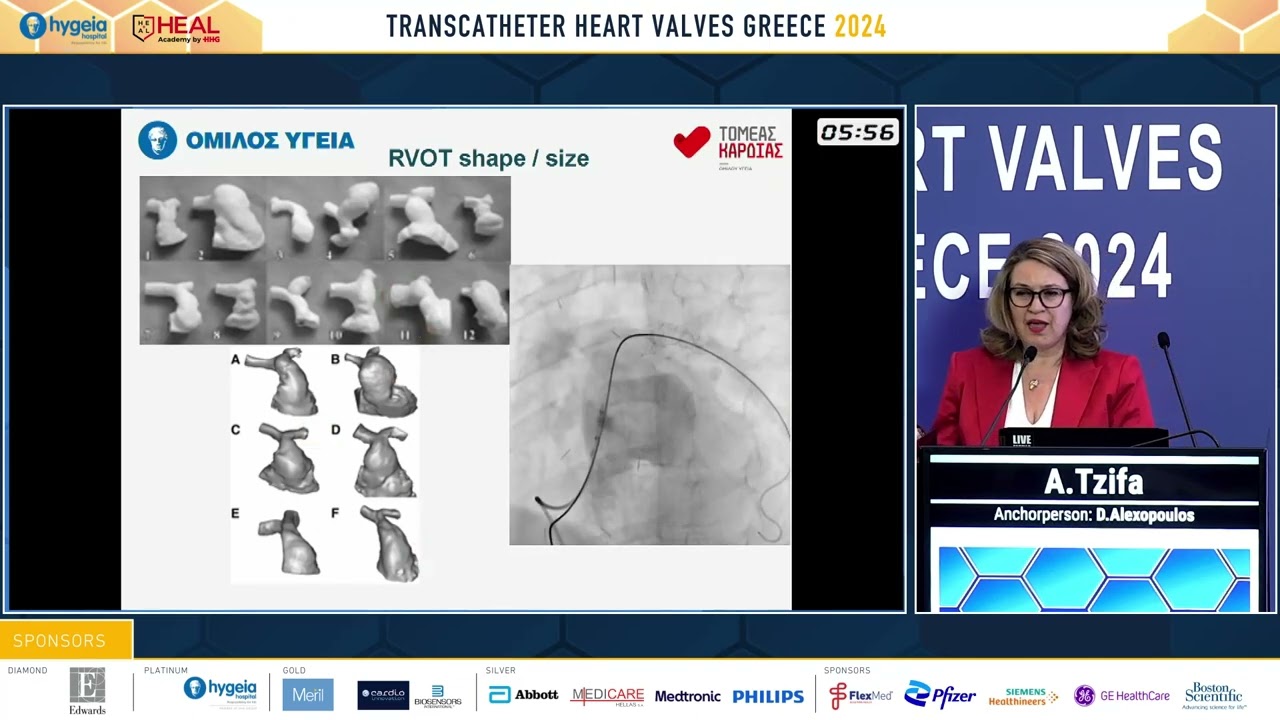 71. Transcatheter interventions for the pulmonic valve | A. Tzifa