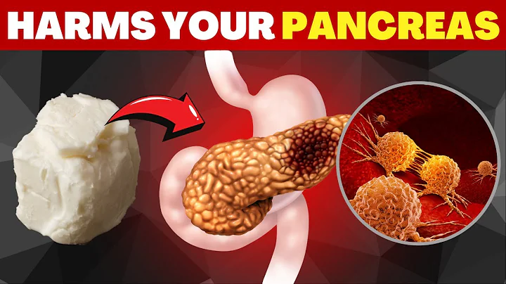 10 Most Dangerous Foods for the Pancreas (Risk of Pancreatic Cancer)