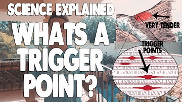What Is A Trigger Point  | Science Explained