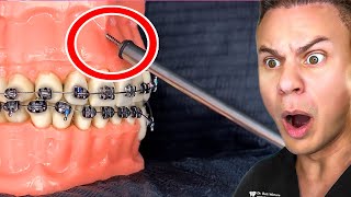 The Scariest Dentist Device You Will Ever See!