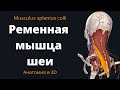 Ременная мышца шеи. Musculus splenius colli. Краткая 3-D анатомия.