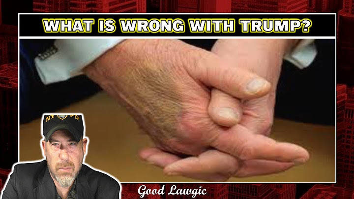 The Following Program: Trump’s Health, Epstein’s Files, Comey Fired and LOTS More