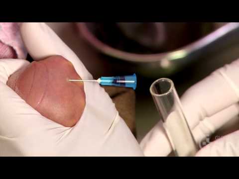 Video: How To Take Blood From A Vein From An Infant
