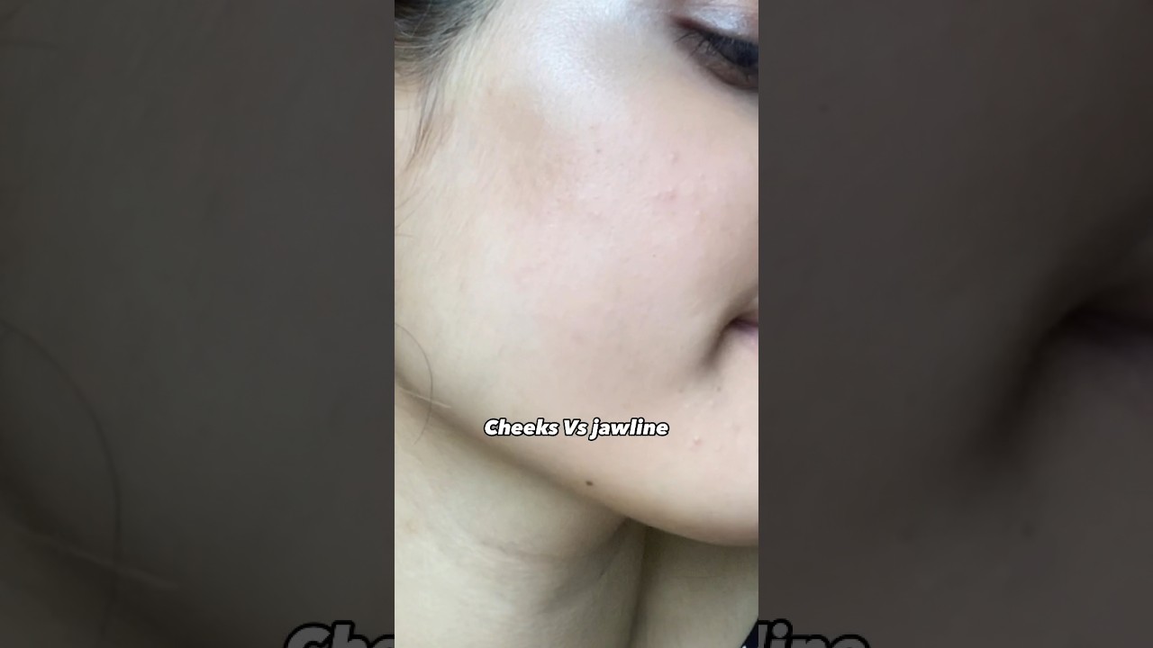 Facial harmony Vs Features 