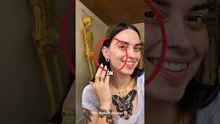 Her Earlobe Ripped But Her Fix Was Shocking
