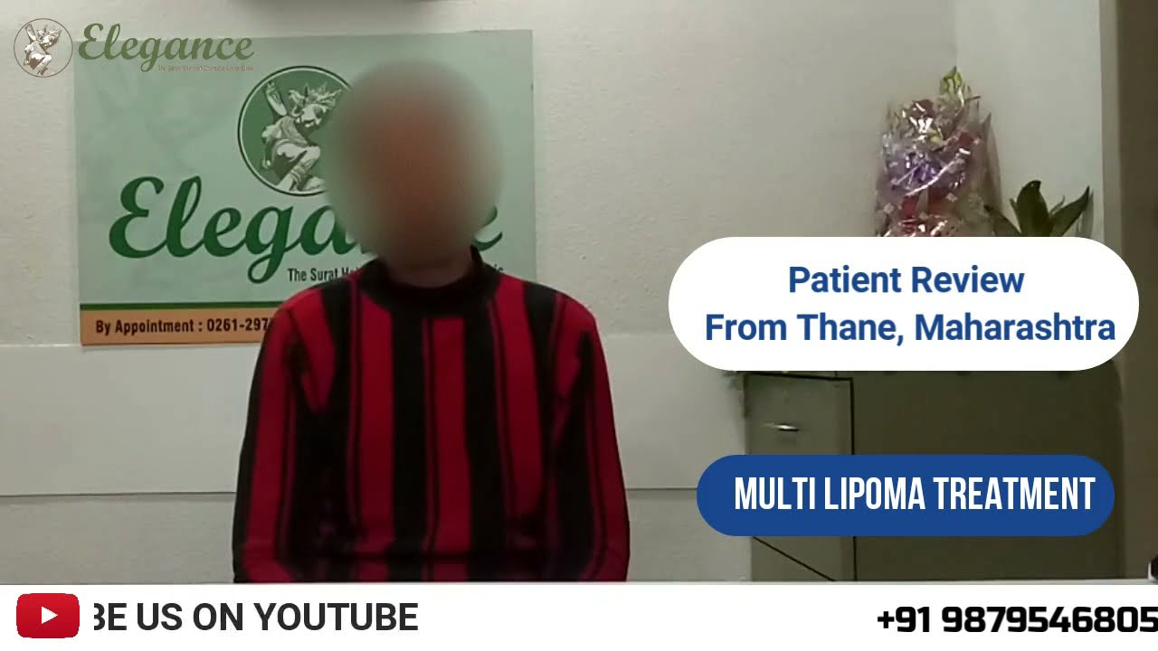 Review- Fatty Lumps Removal, Multiple Lipoma, चर्बीवाली गांठें, Stitchless Lipoma, Surat, Baroda