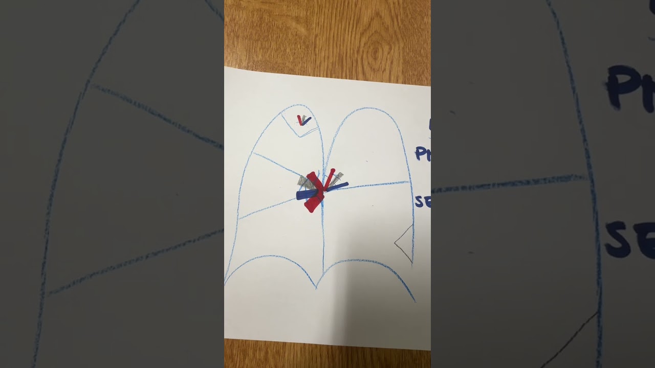 Le resezioni polmonari