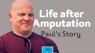 Paul&#39;s Story: Life After Amputation
