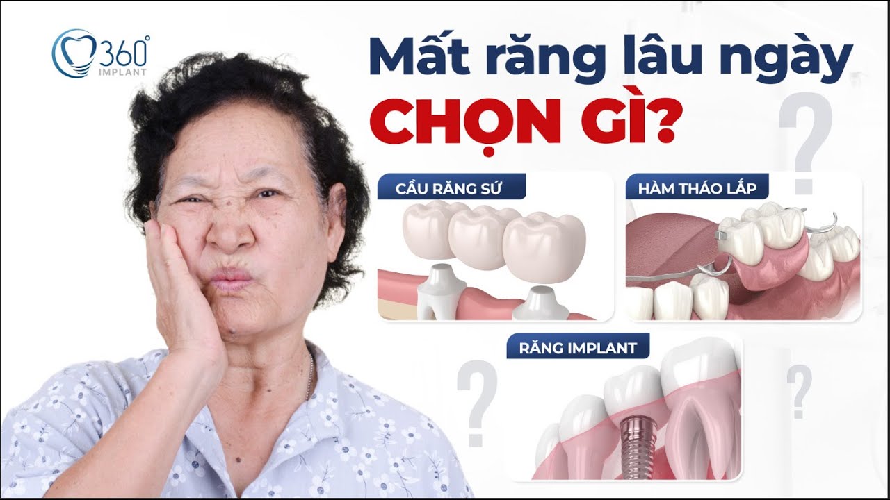 Outline Video Mất Răng Lâu Làm Hàm Tháo Lắp, Cầu Răng Sứ Hay Trồng Implant? So Sánh Các Phương Pháp Phục Hình Răng