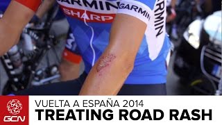 How To Treat Road Rash | Vuelta A España 2014