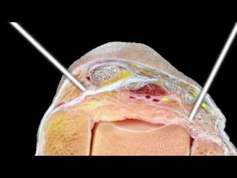 Ankle Arthroscopy: An Update