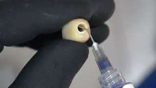 Cementación Variobase (Straumann RC) Zirconio Monolítico