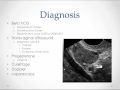 Ectopic Pregnancy - USMLE Step 2 Review