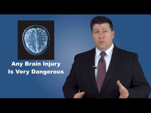 Chicago Brain Injury Attorneys - What YOU Need To Know If You Suspect a Brain Injury.
