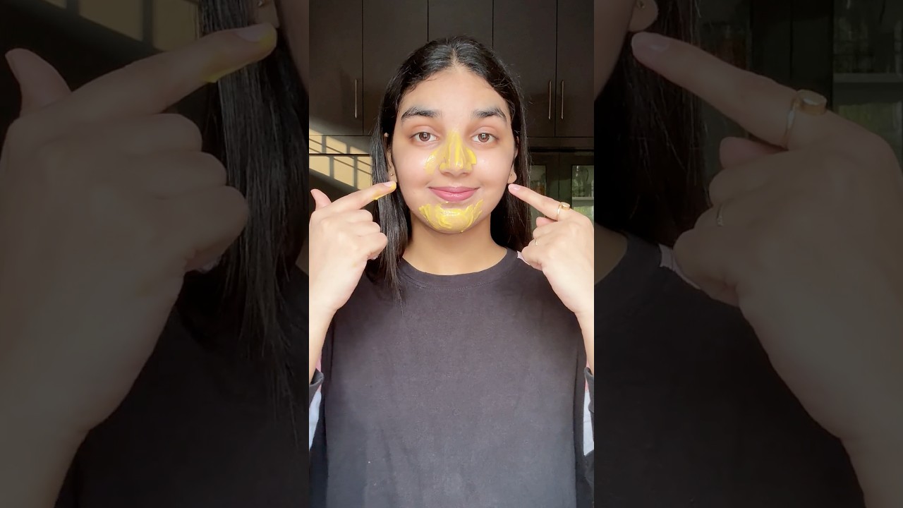 Remove blackheads & whiteheads at home 